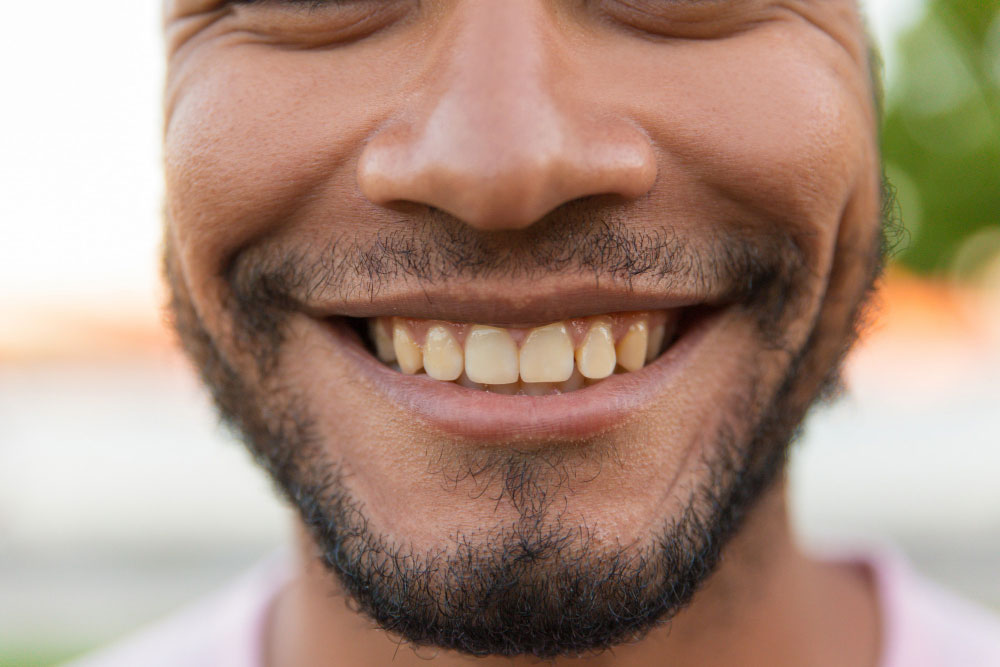 Dakabin-Dental-Ways-of-Fixing-Missing-Cracked-and-Damaged-Teeth.jpg